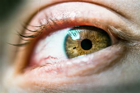 Why Do I Have Pinpoint Pupils? 6 Causes – NVISION