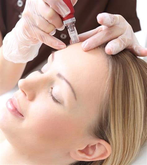 Mesotherapy For The Face – Benefits, Procedure, And Side Effects