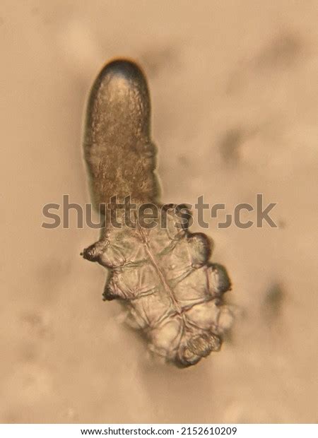 Photo Demodex Face Mites Under Microscope Stock Photo 2152610209 | Shutterstock