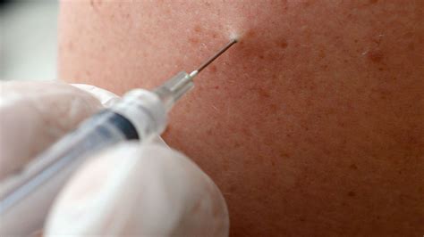 Should meningitis B vaccine be extended to older children? | The Week