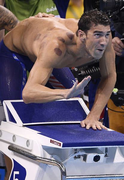 Cupping Therapy: Why Michael Phelps is Covered in Spots at the 2016 Rio ...