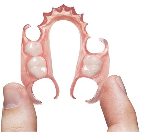 Upper Valplast Flexible partial | QualityDentalLab