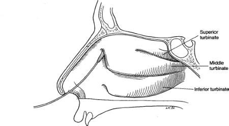 of the Lacrimal System | Plastic Surgery Key