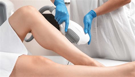 Everything You Need to Know About IPL Hair Removal