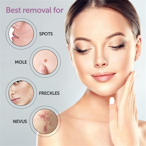 THE BEST and Affordable SKIN TAGS REMOVAL in KL PJ PUCHONG SUBANG KEPONG 便宜又有效的点痣点肉粒油粒镭射 – JY ...