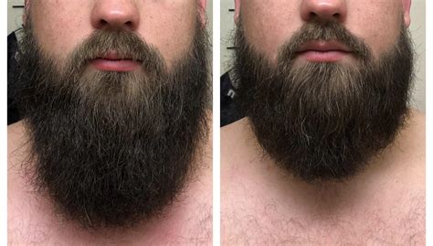 Neckbeard Vs Beard