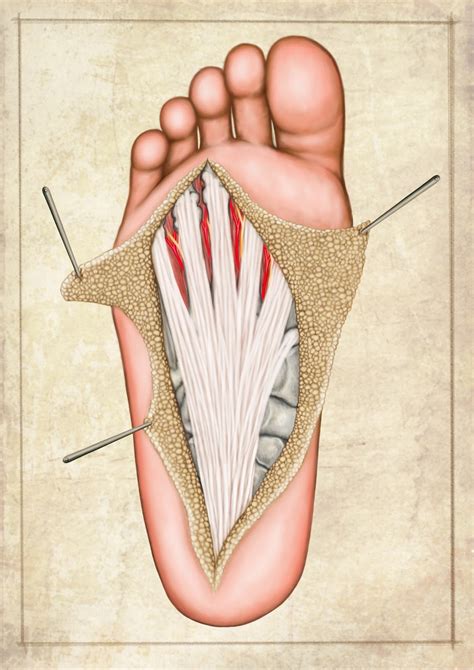 ILLUSTRACIENCIA: Fascia plantar - Eugenio Fernández Pruna