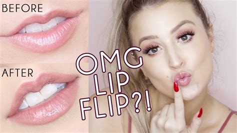 Botox Lip Flip VS Lip Filler - YouTube