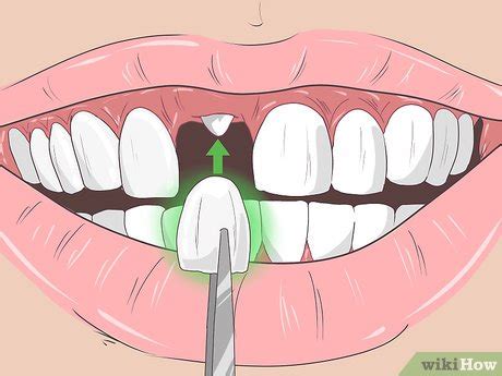 How to Remove Brown Stains from Teeth: 10 Proven Methods