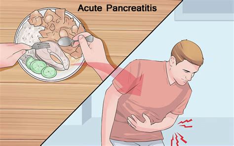 Acute Pancreatitis Symptoms-Causes-Diagnosis and Treatment