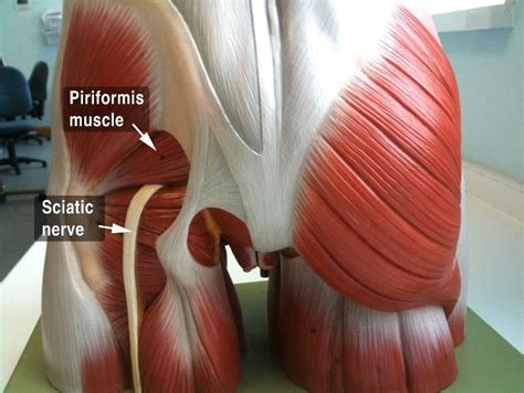 Back Pain Treatment without Surgery | Piriformis Injection | Alleviate Pain Clinic