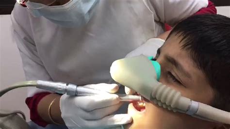 Dental Treatment under Laughing Gas Anaesthesia - YouTube