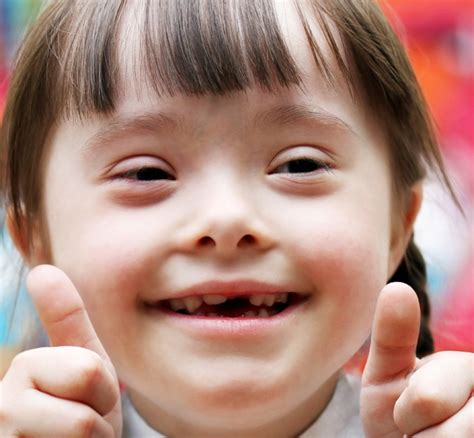 Down Syndrome: Understanding the Genetic Basis – minagene