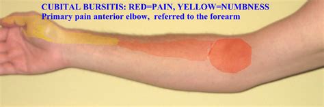 Antecubital Region Of Arm