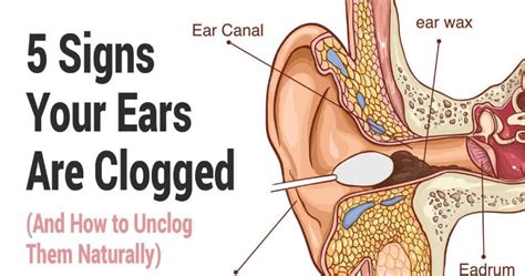 Signs Of Clogged Ears And How To Unclog Them - Kaiser Magazine