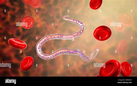 Wuchereria bancrofti. Computer illustration of the microfilaria larval ...