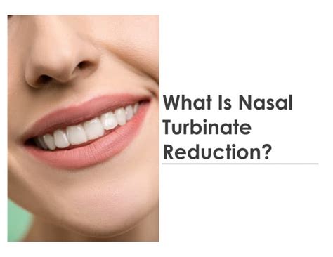 What Is Nasal Turbinate Reduction? | PPT