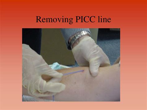 drawing blood cultures from picc - Thurman Switzer