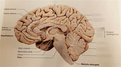 Sagittal View of the Brain - Part 1 Diagram | Quizlet