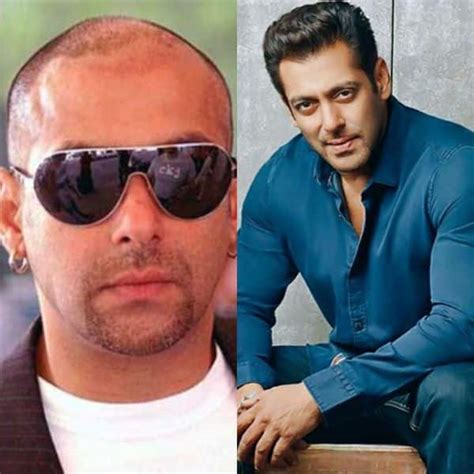 SHOCKING! 5 Bollywood actors who underwent for hair transplant