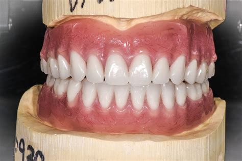 Full Dentures • Triad Dental Studio