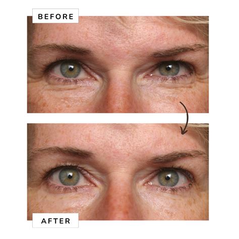Vita-Peptides 10-second Wrinkle Eraser Eye Cream | Be You – Beyou Cosmetics