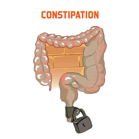 Constipation Treatment Coimbatore, Remedy Constipation Hospital Near Me ...