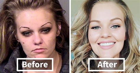 24 Stunning Before & After Transformations Of People Who Quit Drugs | Bored Panda
