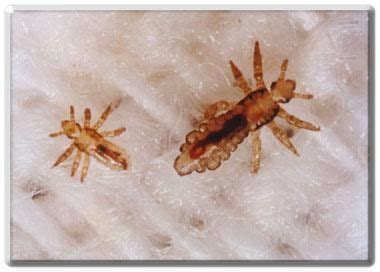 Nymphs (baby lice) these are teeny tiny lice, about a week from ...