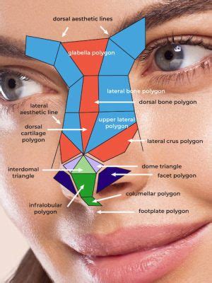 Bulbous Tip Rhinoplasty NYC | Wide Nasal Tip New York City