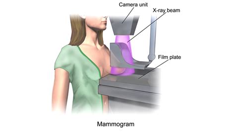 Mammography