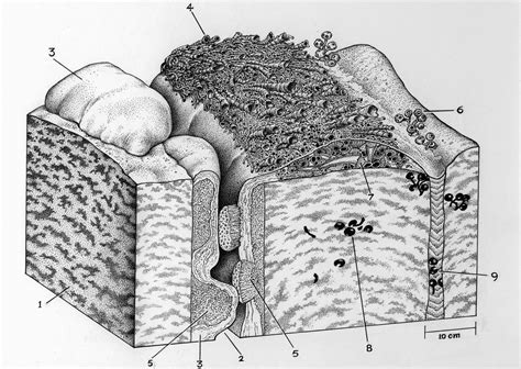 The Dragon's Tales: Cloudina Made Reefs in the Ediacaran NeoProterozoic