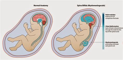 dari mata hati: Cara Meningkatkan Paras HB Dengan Cepat!