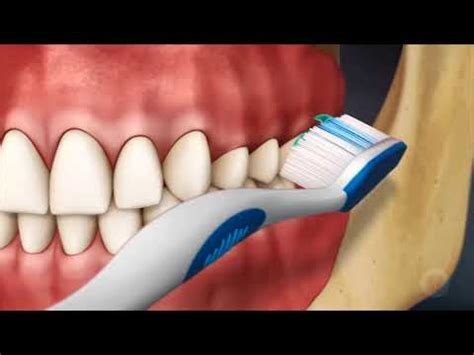 Modified Bass Brushing Technique - Brace Dental Clinics - YouTube