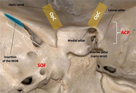 Dry skull showing the anatomic configuration of the anterior clinoid... | Download Scientific ...