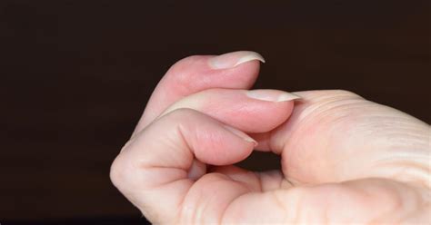 Finger Clubbing - Symptoms, Causes, Treatments