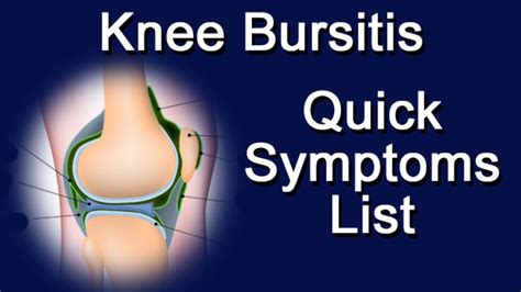 Knee Bursitis - Quick Symptoms List - YouTube