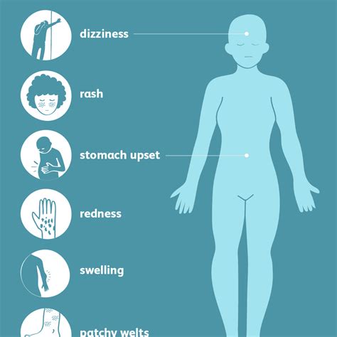 Angioedema: Signs, Symptoms, and Complications