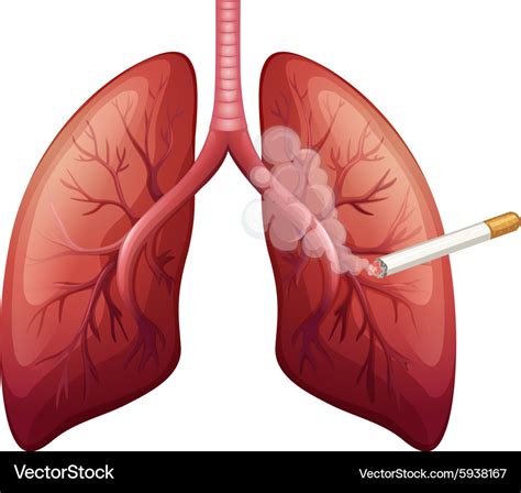 Lung cancer with smoke Royalty Free Vector Image