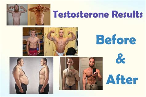 Treatment of Low Testosterone: Before and After - HRTUS