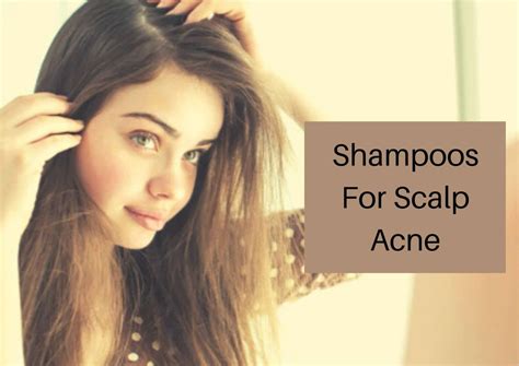 6 Best Shampoo To Treat Scalp Acne In 2023 - Hair Everyday Review