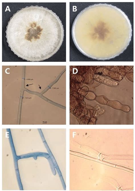 Microscopic and macroscopic characteristics of Rhizoctonia solani ...