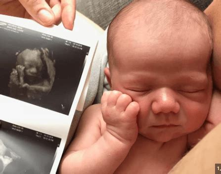 "In Living Color: Exploring the Marvels of 3D Ultrasound 30 Weeks" - Newszpedia
