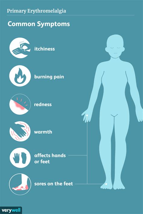 Erythromelalgia: A Very Rare Condition