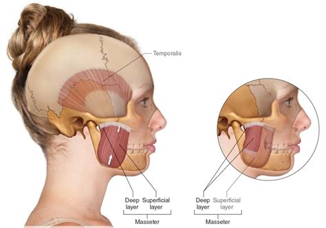 Masseter muscle - Origin, Insertion, Function, Exercise