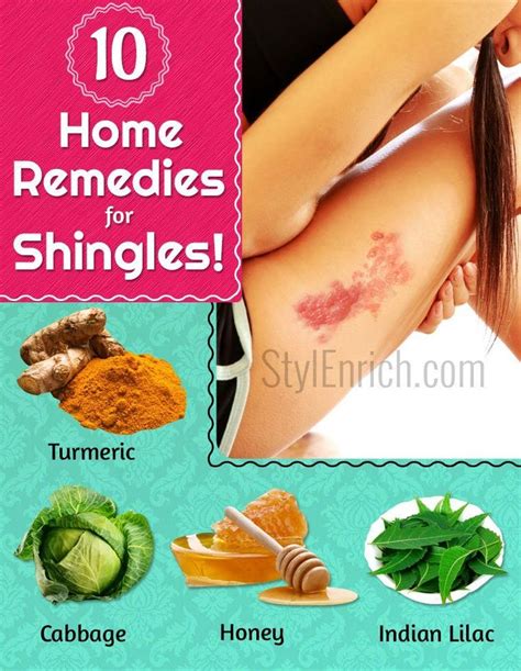 Home Remedies For Shingles : How To Get Rid of Shingles? | Holistic health remedies, Shingles ...