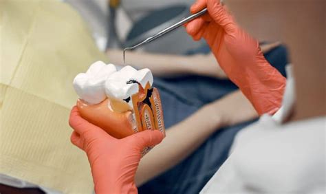 Root Canal Aftercare 101: How to Ensure a Smooth Recovery