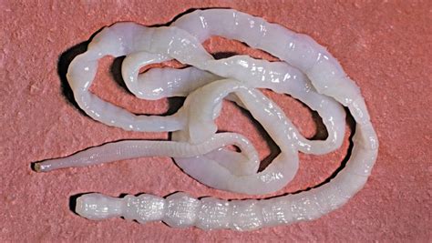 Parasite expert tells shocking story of human tapeworm - ABC Adelaide