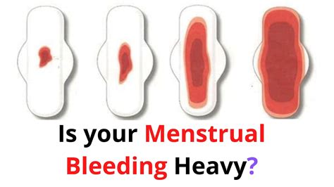 Is your Menstrual Bleeding Heavy - Reasons & How to stop it.