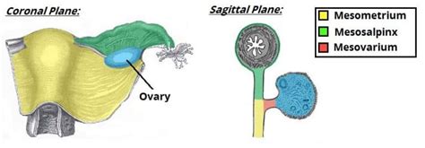 Ligaments of the Female Reproductive Tract - TeachMeAnatomy